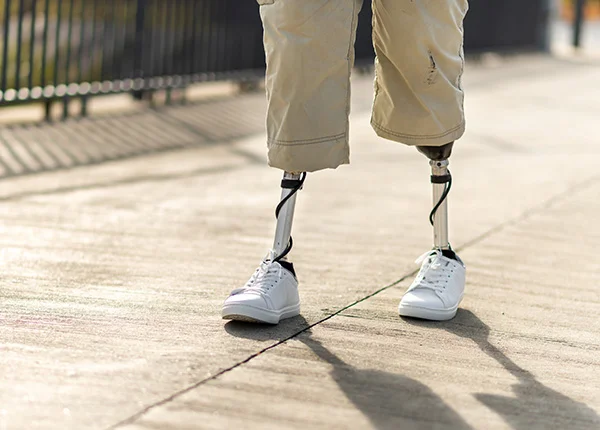 Oral Presentation at the XIth International Prosthetics and Orthotics Congress Image